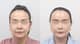 Slider image (6) AB Plastic Surgery